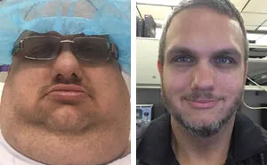 256 Times People Surprised Everyone By Losing So Much Weight They Looked Like A Different Person (New Pics)