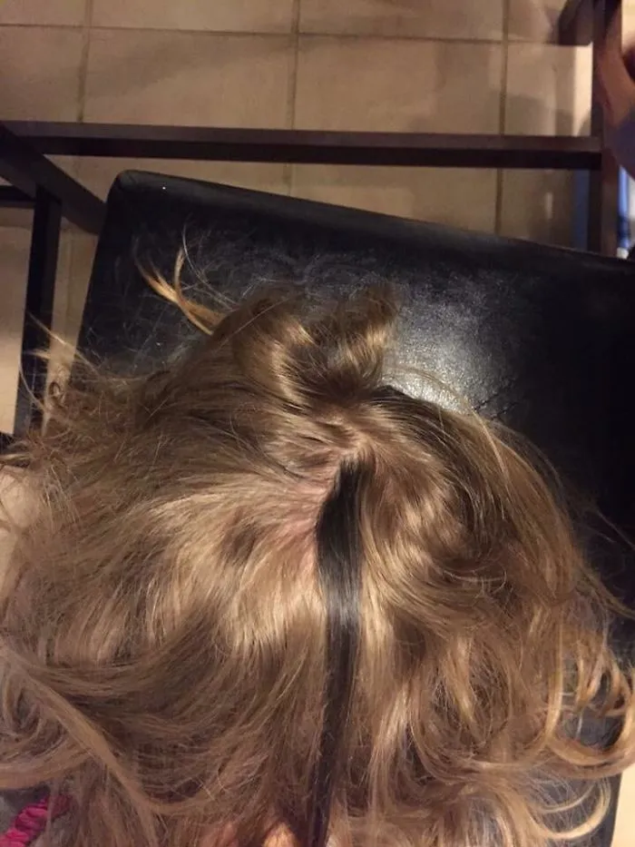 Mi hijo tiene un mechón de pelo muy oscuro