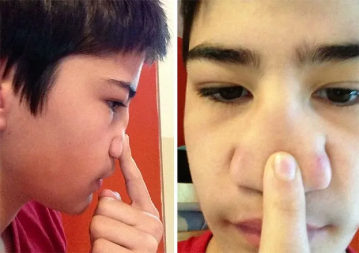I Was Born Without A Bridge In My Nose