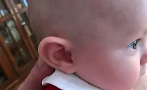 30 People Whose Genetics Made Them Unique