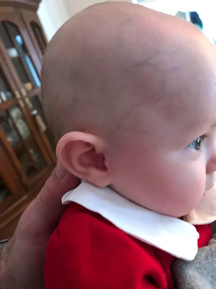 My Daughter Was Born With A Perfect Number 2 On Her Head