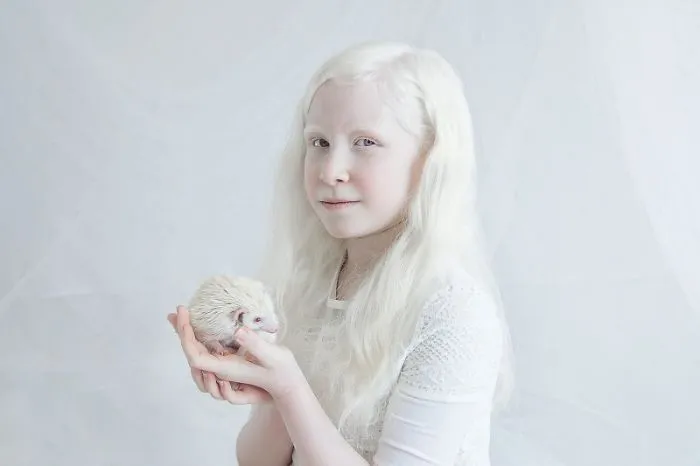 Artist Captures The Beauty Of Albinos And It's Absolutely Breathtaking