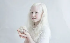 Artist Captures The Beauty Of Albinos And It's Absolutely Breathtaking