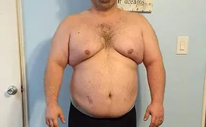 After Neglecting My Body For 10 Years, I Started Making Small Changes And Went From 300lbs To 150lbs