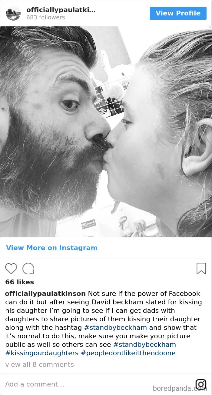 Kiss On Lips