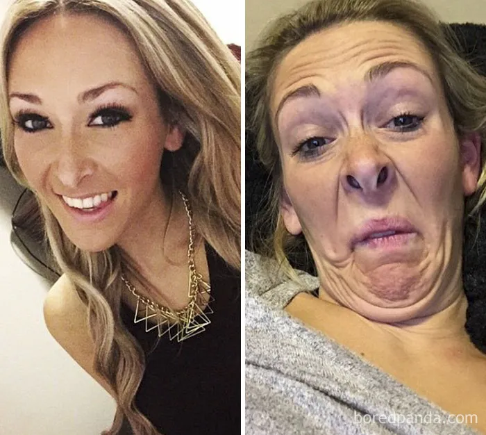 Before And After
