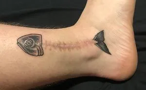 25 Times People Asked To Cover Up Their Scars And Birthmarks, And Tattoo Artists Nailed It