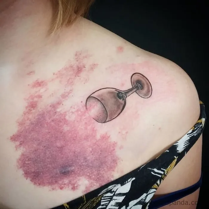 40 Tatuadores que triunfaron cubriendo cicatrices y marcas de nacimiento