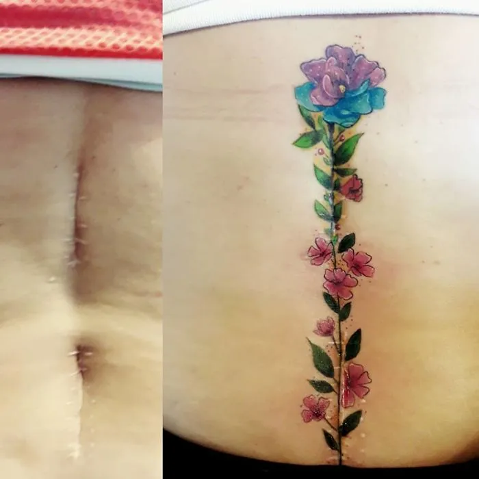 40 Tatuadores que triunfaron cubriendo cicatrices y marcas de nacimiento