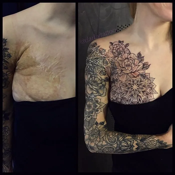 40 Tatuadores que triunfaron cubriendo cicatrices y marcas de nacimiento