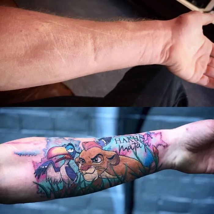 40 Tatuadores que triunfaron cubriendo cicatrices y marcas de nacimiento