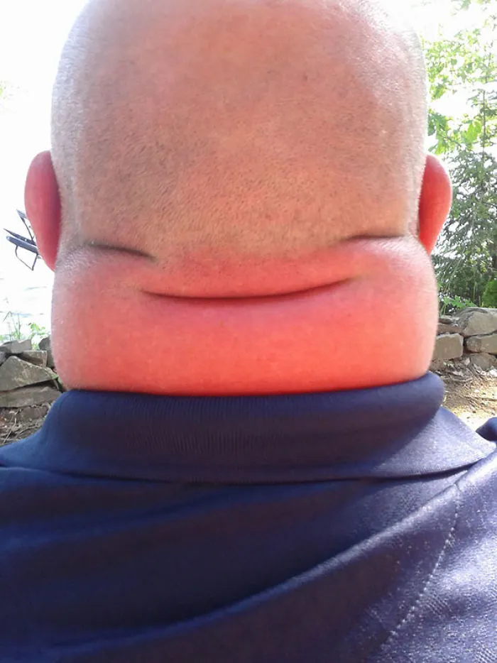 Cuello feliz