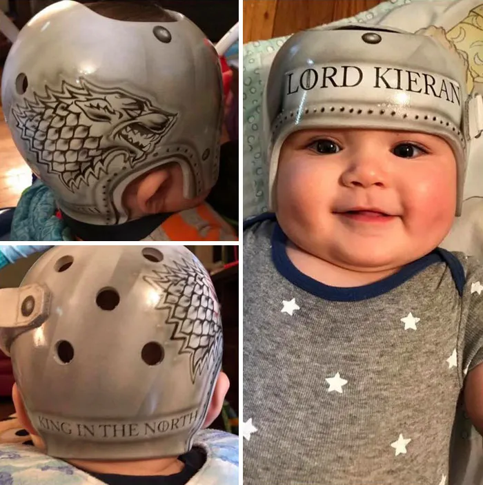 My Baby Wore A Helmet. He’s 2 Now And His Head Isn’t Flat Anymore. They Work And They’re Cute And Fuck You If You Judge A Mom For It. 🤷🏻‍♀️🐺⚔️  Ps. Winter Is Coming