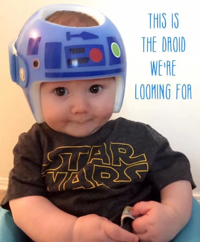 This Is My Cutie!   I Remember Feeling So Anguished Over Him Getting This Helmet But Honestly It’s No Different Than Him Needing Braces.   Support And Love Are What All Mothers Need! Happy To Share And Happy To Support!