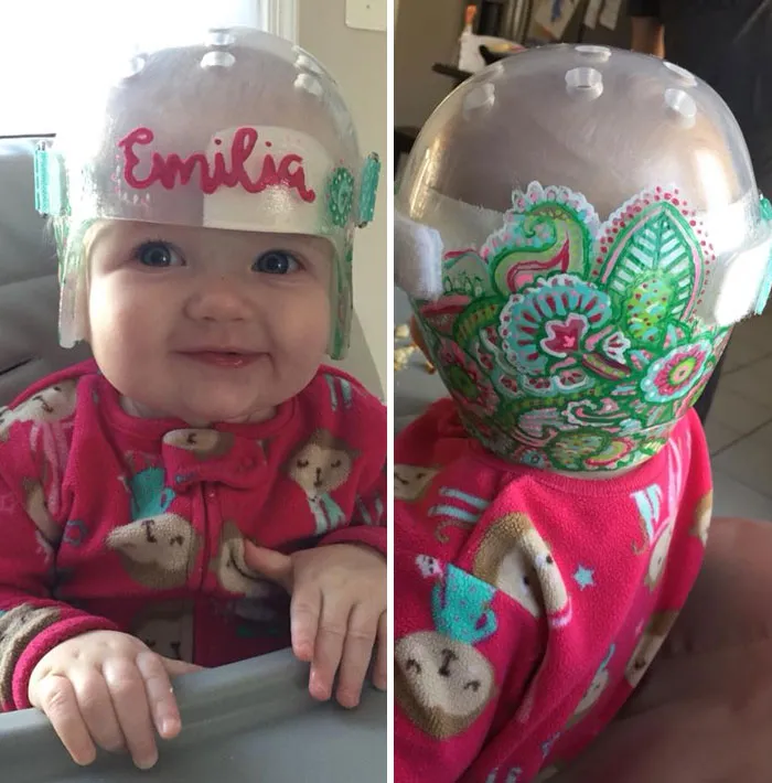 Mommy To A Craniosynostosis Warrior!