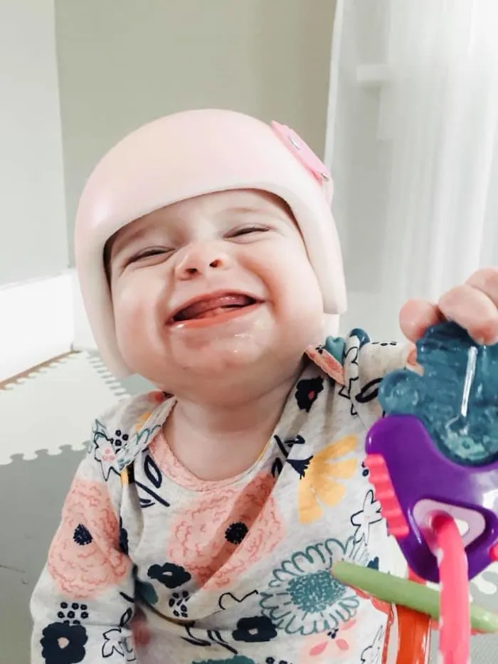 This Is The Day She Got Her Helmet And We’re On Our 3rd Month. Her Head Is Looking Great So We Think She’ll Be Done This Month Or Next. She Adapted To It Right Away And Continued To Be A Great Sleeper Too!