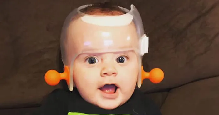 Chrissy Teigen Shares A Picture Of Her Son With A Head-Shaping Helmet, People Come To Support Her With Pictures Of Their Children	