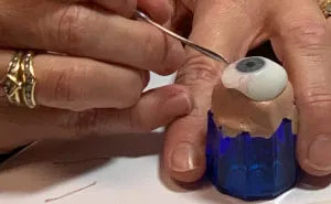 7 Months Ago My Husband Lost His Eye, I Documented The Weekend When He Finally Got A New One (Warning: Sensitive Content)