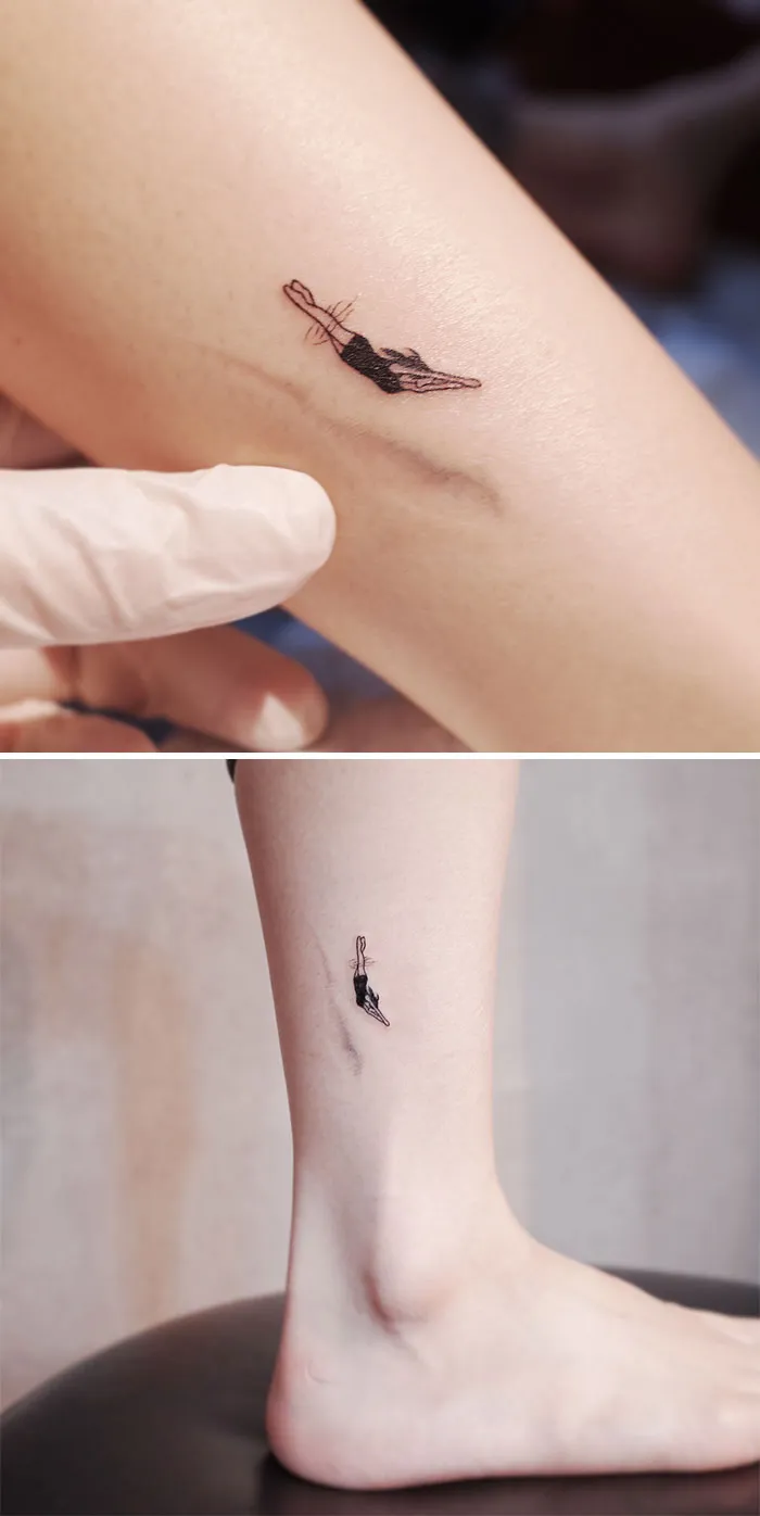 40 Tatuadores que triunfaron cubriendo cicatrices y marcas de nacimiento