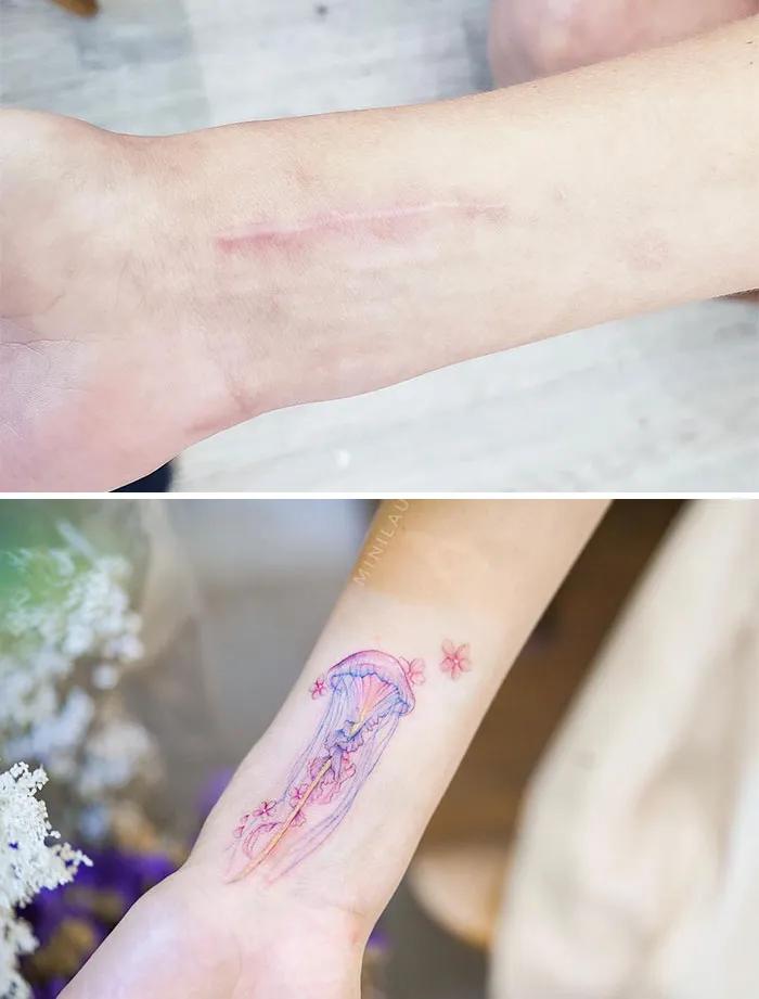 40 Tatuadores que triunfaron cubriendo cicatrices y marcas de nacimiento