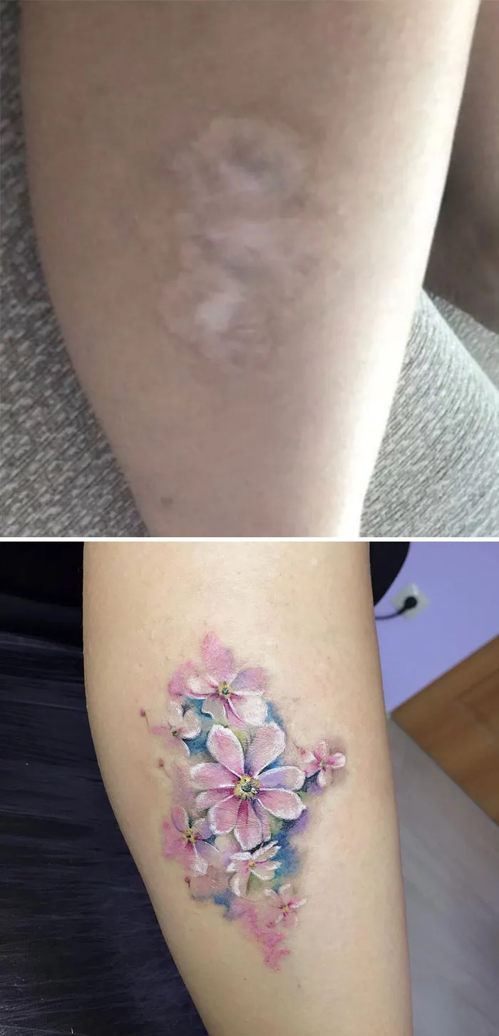 40 Tatuadores que triunfaron cubriendo cicatrices y marcas de nacimiento