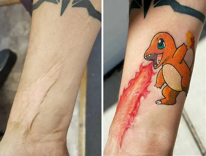 40 Tatuadores que triunfaron cubriendo cicatrices y marcas de nacimiento