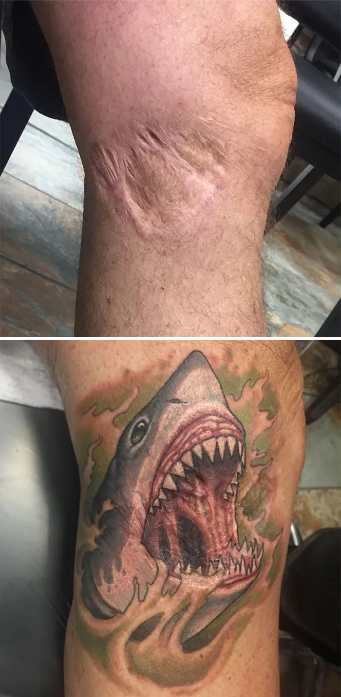 40 Tatuadores que triunfaron cubriendo cicatrices y marcas de nacimiento