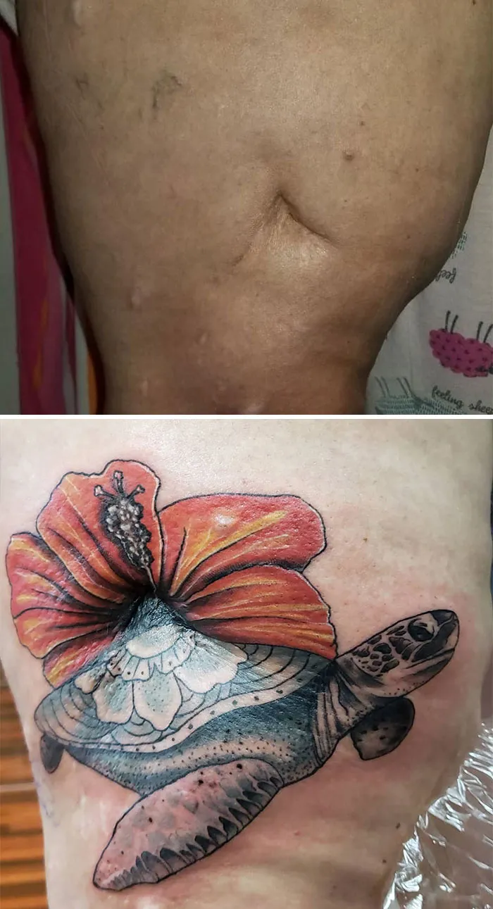 40 Tatuadores que triunfaron cubriendo cicatrices y marcas de nacimiento