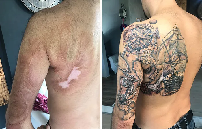 40 Tatuadores que triunfaron cubriendo cicatrices y marcas de nacimiento