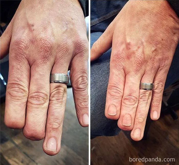 40 Tatuadores que triunfaron cubriendo cicatrices y marcas de nacimiento
