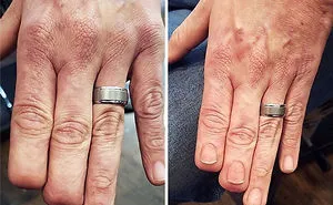 25 Times People Asked To Cover Up Their Scars And Birthmarks, And Tattoo Artists Nailed It
