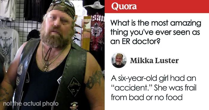 Someone Asks ER Doctors What Are The Most Amazing Things They Have Seen, And This Answer Wins