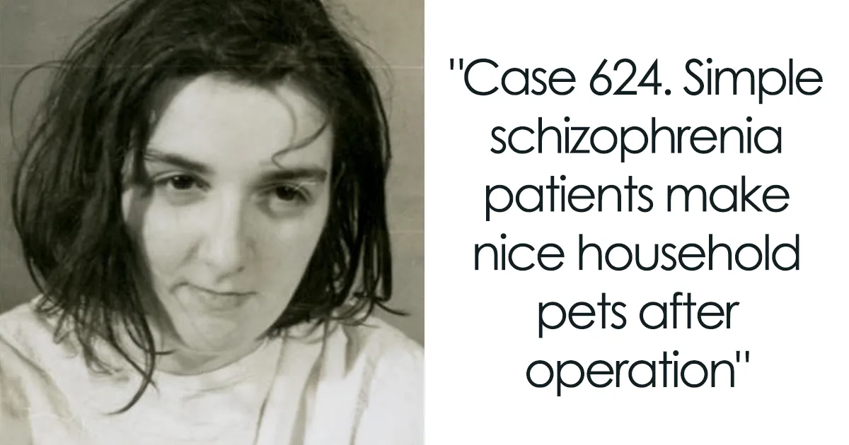 21 Disturbing Pictures of Lobotomy Before and After