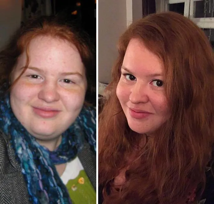 People Share Their Pics For The #10YearChallenge And Some Are Unrecognizable