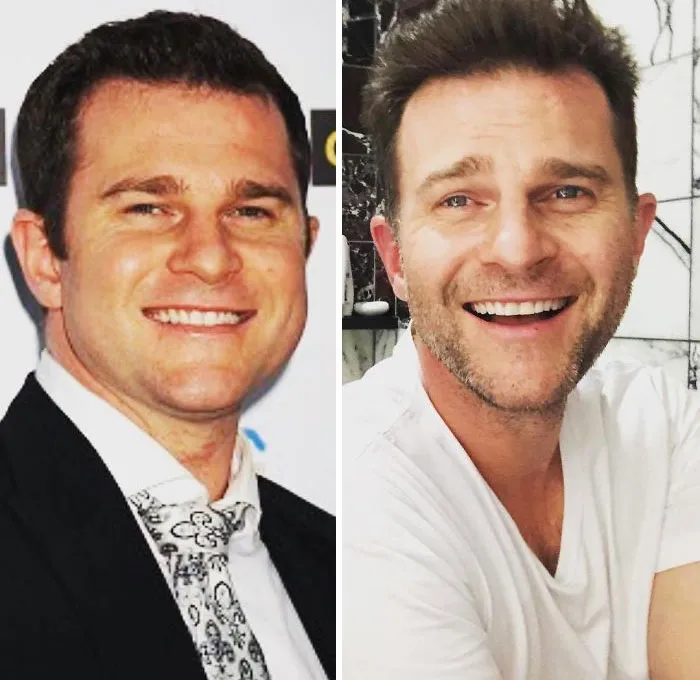 La gente comparte sus fotos para el #10YearChallenge y algunos son irreconocibles