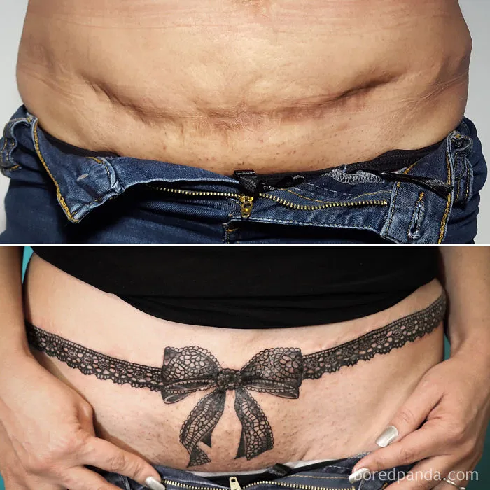 Tattoo artist creatively covers scars with a lace bow design, transforming the appearance beautifully.