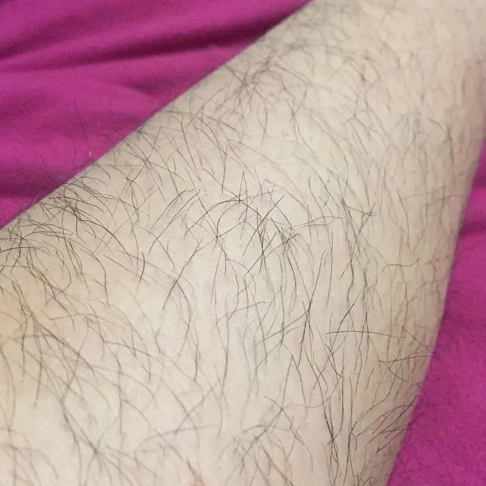 40 Mujeres que eligieron no depilarse por "Januhairy" y comparten fotos de sus progresos
