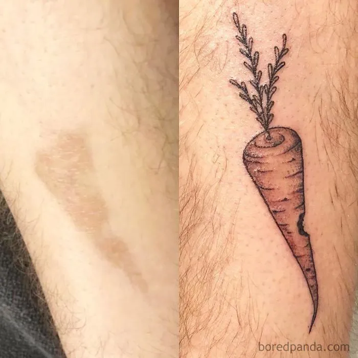 40 Tatuadores que triunfaron cubriendo cicatrices y marcas de nacimiento