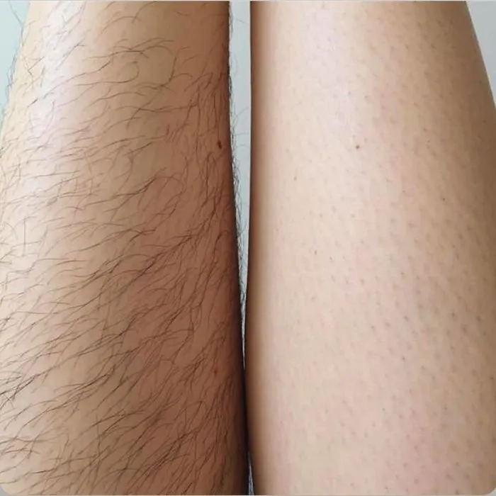 40 Mujeres que eligieron no depilarse por "Januhairy" y comparten fotos de sus progresos