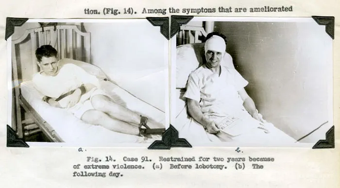 A Haunting Glimpse Into Medical History
