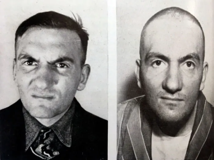 21 Disturbing Pictures of Lobotomy Before and After