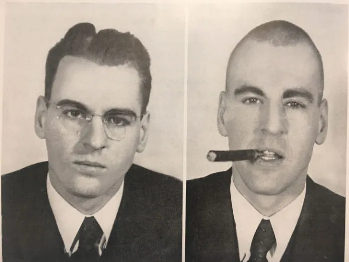 21 Disturbing Pictures of Lobotomy Before and After