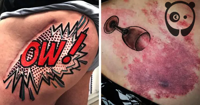 People Asked To Cover Up Their Scars And Birthmarks And Tattoo Artists Nailed It