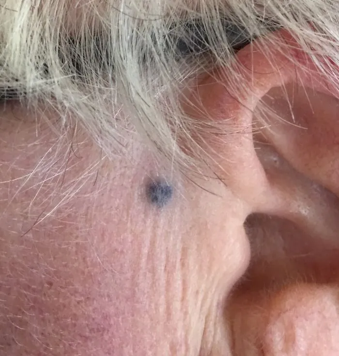 Stabbed With Pencil