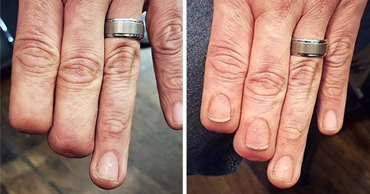 40 Tatuadores que triunfaron cubriendo cicatrices y marcas de nacimiento