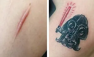 25 Times People Asked To Cover Up Their Scars And Birthmarks, And Tattoo Artists Nailed It