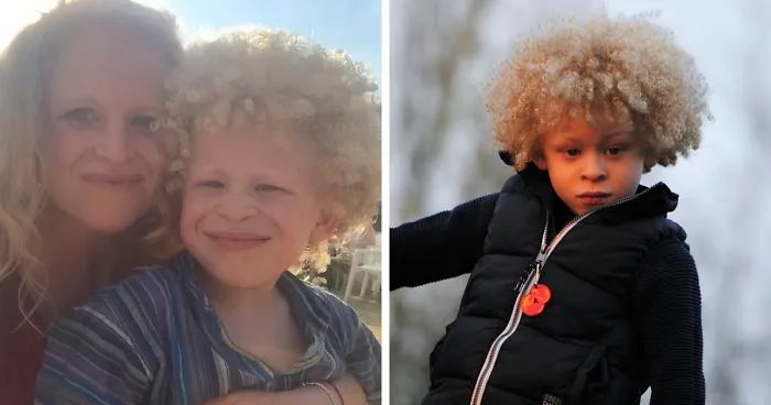 5-Year-Old Albino Boy Becomes Model For Primark After Mum Shares His Pic On Facebook