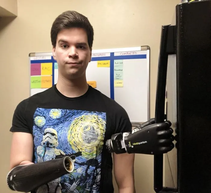Went To Open My Fridge. Definitely Thought My Hand Was Connected Properly