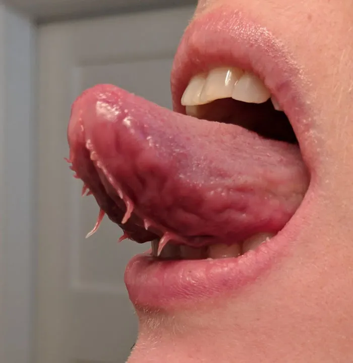 Tengo tentaculitos bajo la lengua