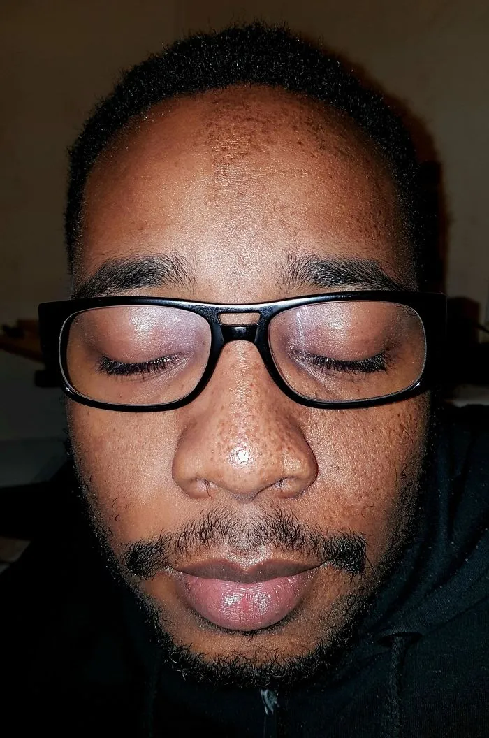 Mi novio solo tiene pecas en la mitad de la cara